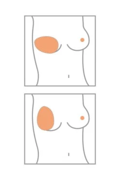 Amoena Teilprothese Balance Essential Thin Oval -Amoena Verkäufe Amoena Brustprothesen Form Oval min 1280x1280