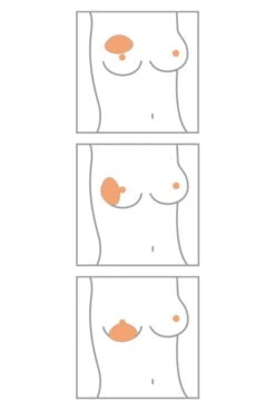 Amoena Teilprothese Balance Contact Spezial Varia 5 Amoena Teilprothese Balance Contact Spezial Varia -Amoena Verkäufe Amoena Brustprothesen Form Varia min 1280x1280